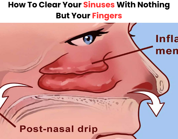 How To Clear Your Sinuses With Nothing But Your Fingers 600 x 503 px