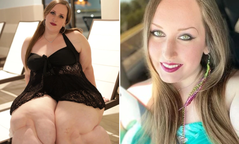 I Was Shamed for My Weight by Doctors Then a Stranger Revealed the Truth to Me