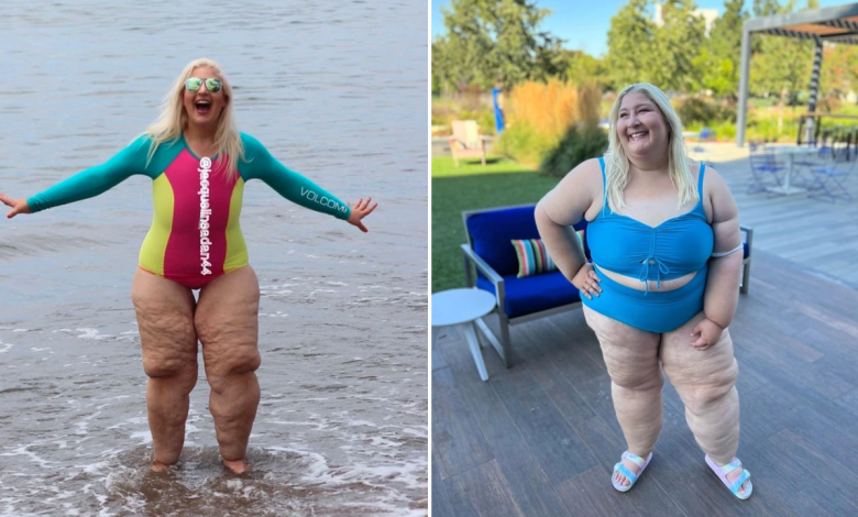 This Woman Had the Perfect Response After Being Shamed for Her Loose Skin