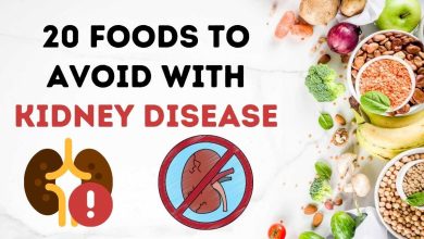 20 Foods to avoid with kidney di