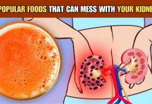 Foods That Can Mess With Your Kidneys