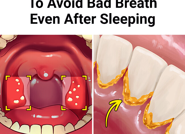 6 Effective Ways To Avoid Bad Breath Even After Sleeping