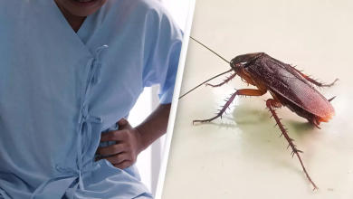 Man Complaining Of Indigestion Discovered He Had Live ThreeCentimeter Cockroach In His Intestines2